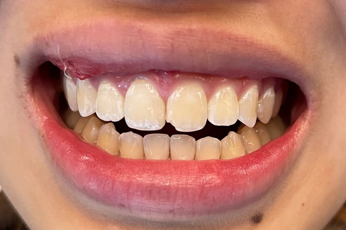 Dr. Leo C Yang - Modern Dentistry in Mill Valley