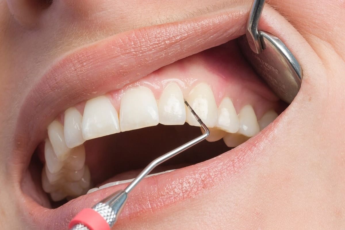 Ukiah Dental | Dr. Richard S. Phillips DDS